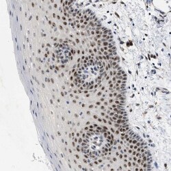 ELAC2 Antibody, Novus Biologicals 25 &mu;L | Buy Online | Novus Biologicals | Fisher Scientific
