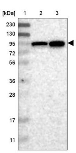 ELAC2 Antibody, Novus Biologicals 25 &mu;L | Buy Online | Novus Biologicals | Fisher Scientific
