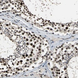 ELF2 Antibody, Novus Biologicals 25 &mu;L; Unlabeled:Antibodies, Polyclonal