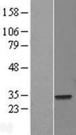 Novus Biologicals&trade;&nbsp;ELF5 Overexpression Lysate