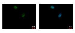 ELK3 Antibody, Novus Biologicals 0.1mL; Unlabeled:Antibodies, Polyclonal