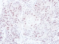 ELK3 Antibody, Novus Biologicals 0.1mL; Unlabeled:Antibodies, Polyclonal