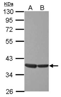ELK3 Antibody, Novus Biologicals 0.1mL; Unlabeled:Antibodies, Polyclonal