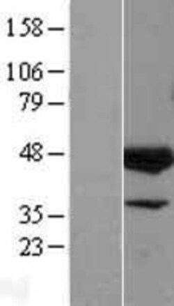 Novus Biologicals™ ELK3 Overexpression Lysate