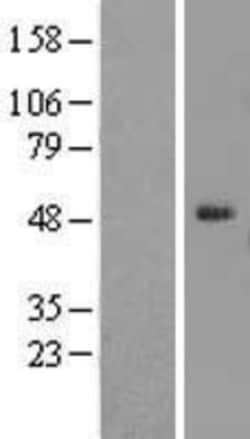 Novus Biologicals&trade;&nbsp;ELK4 Overexpression Lysate