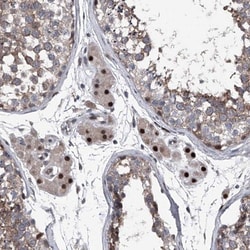 ELK4 Antibody, Novus Biologicals:Antibodies:Primary Antibodies