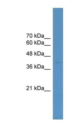 ELK4 Antibody, Novus Biologicals:Antibodies:Primary Antibodies