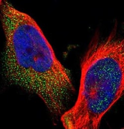 ELKS Antibody, Novus Biologicals:Antibodies:Primary Antibodies