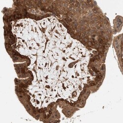 ELKS Antibody, Novus Biologicals:Antibodies:Primary Antibodies