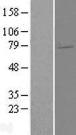 Novus Biologicals&trade;&nbsp;ELL2 Overexpression Lysate