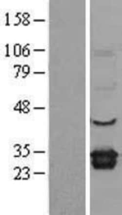 Novus Biologicals&trade;&nbsp;ELMO1 Overexpression Lysate
