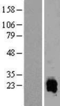 Novus Biologicals&trade;&nbsp;ELMO1 Overexpression Lysate
