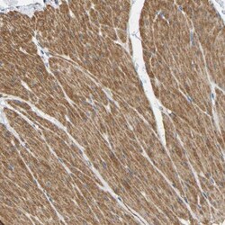 ELMO2 Antibody, Novus Biologicals 0.1mL; Unlabeled:Antibodies, Polyclonal