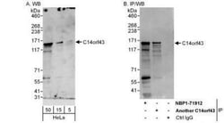 ELMSAN1 Antibody, Novus Biologicals 0.1mg; Unlabeled:Antibodies, Polyclonal