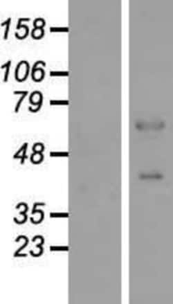 Novus Biologicals&trade;&nbsp;ELOA3 Overexpression Lysate