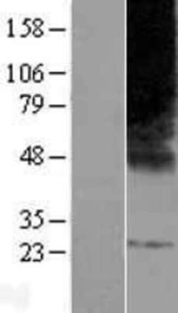 Novus Biologicals&trade;&nbsp;ELOVL3 Overexpression Lysate