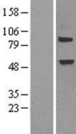 Novus Biologicals&trade;&nbsp;Elp3 Overexpression Lysate