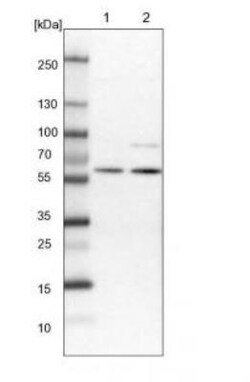 Elp3 Antibody, Novus Biologicals:Antibodies:Primary Antibodies