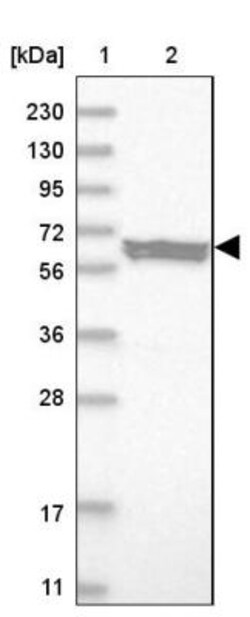 Elp3 Antibody, Novus Biologicals:Antibodies:Primary Antibodies