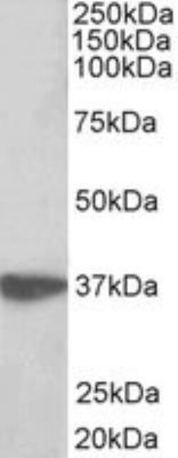 EMAP-II/AIMP1 Antibody, Novus Biologicals 0.1mg; Unlabeled:Antibodies,