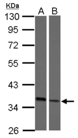 Embigin/EMB Antibody, Novus Biologicals 0.1mL; Unlabeled:Antibodies, Polyclonal