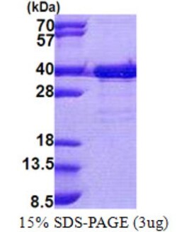 Novus Biologicals&trade;&nbsp;Recombinant Human EMC2 His Protein