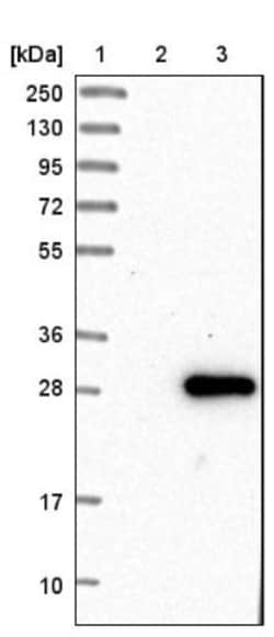 EMC7 Antibody, Novus Biologicals 0.1mL; Unlabeled:Antibodies, Polyclonal
