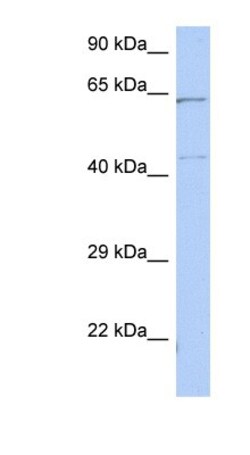EME1 Antibody, Novus Biologicals 100 &mu;L | Buy Online | Novus Biologicals | Fisher Scientific