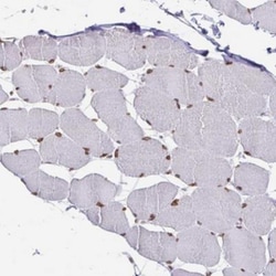 Emerin Antibody, Novus Biologicals 0.1mL; Unlabeled:Antibodies, Polyclonal