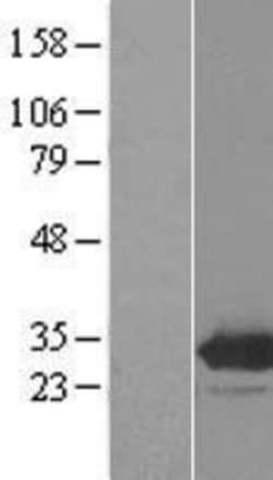 Novus Biologicals™ EMG1 Overexpression Lysate