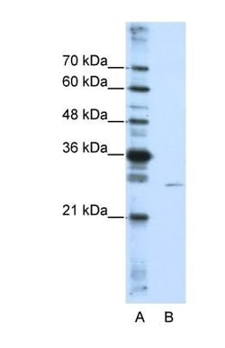 EMG1 Antibody, Novus Biologicals 100&mu;L; Unlabeled:Antibodies, Polyclonal