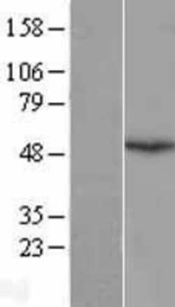 Novus Biologicals&trade;&nbsp;EMI1 Overexpression Lysate