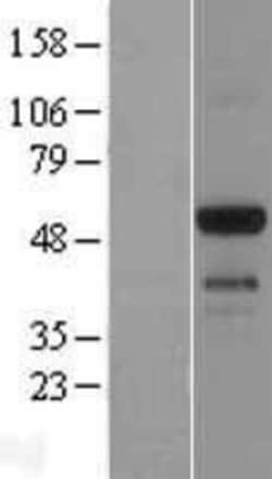 Novus Biologicals™ EMID1 Overexpression Lysate