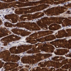 EMID1 Antibody, Novus Biologicals 25 &mu;L; Unlabeled:Antibodies, Polyclonal