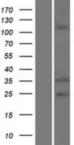 Novus Biologicals&trade;&nbsp;EMILIN2 Overexpression Lysate
