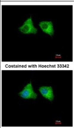 EML1 Antibody, Novus Biologicals 0.1mL; Unlabeled:Antibodies, Polyclonal