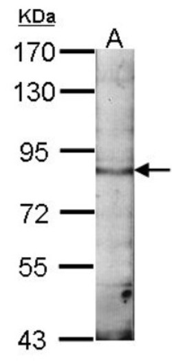 EML1 Antibody, Novus Biologicals 0.1mg; Unlabeled:Antikörper