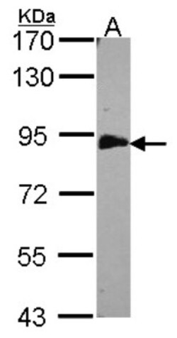 EML1 Antibody, Novus Biologicals 0.1mg; Unlabeled:Antikörper