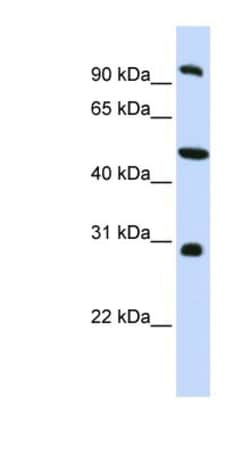 EML1 Antibody, Novus Biologicals 100&mu;L; Unlabeled:Antibodies, Polyclonal