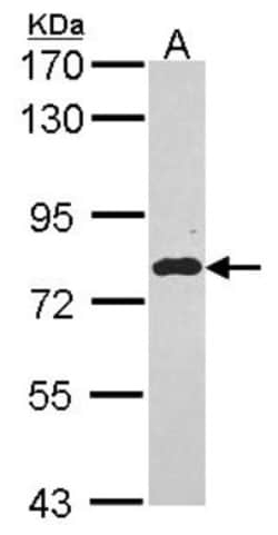EML1 Antibody, Novus Biologicals 0.1mL; Unlabeled:Antibodies, Polyclonal