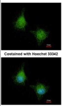 EML2 Antibody, Novus Biologicals 0.1mL; Unlabeled:Antibodies, Polyclonal
