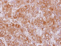 EML2 Antibody, Novus Biologicals 0.1mL; Unlabeled:Antibodies, Polyclonal