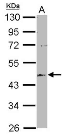 EML2 Antibody, Novus Biologicals 0.1mL; Unlabeled:Antibodies, Polyclonal