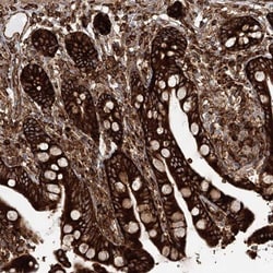 VAMP-5 Antibody, Novus Biologicals:Antibodies:Primary Antibodies