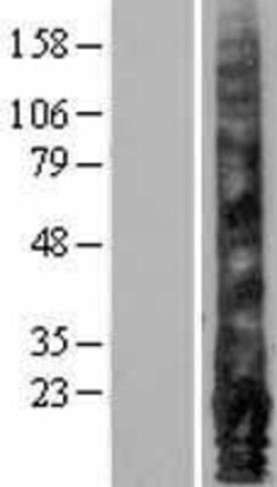 Novus Biologicals&trade;&nbsp;EMP1 Overexpression Lysate