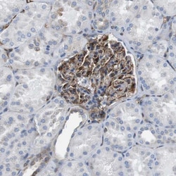 DNMT3A Antibody, Novus Biologicals:Antibodies:Primary Antibodies