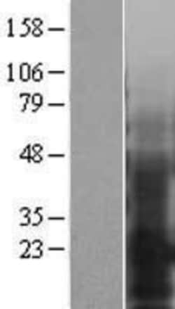 Novus Biologicals&trade;&nbsp;EMP3 Overexpression Lysate
