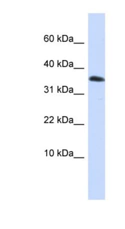 Emx1 Antibody, Novus Biologicals 0.05mg; Unlabeled:Antibodies, Polyclonal