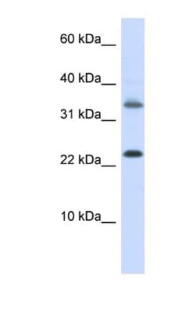 Emx1 Antibody, Novus Biologicals 100&mu;L; Unlabeled:Antibodies, Polyclonal