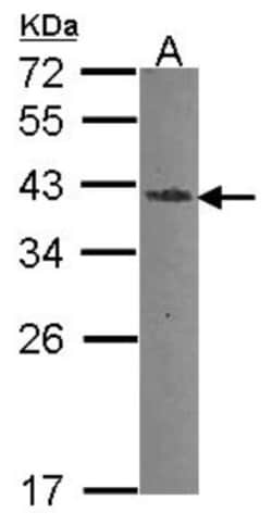 Endo G Antibody, Novus Biologicals 0.1mL; Unlabeled:Antibodies, Polyclonal